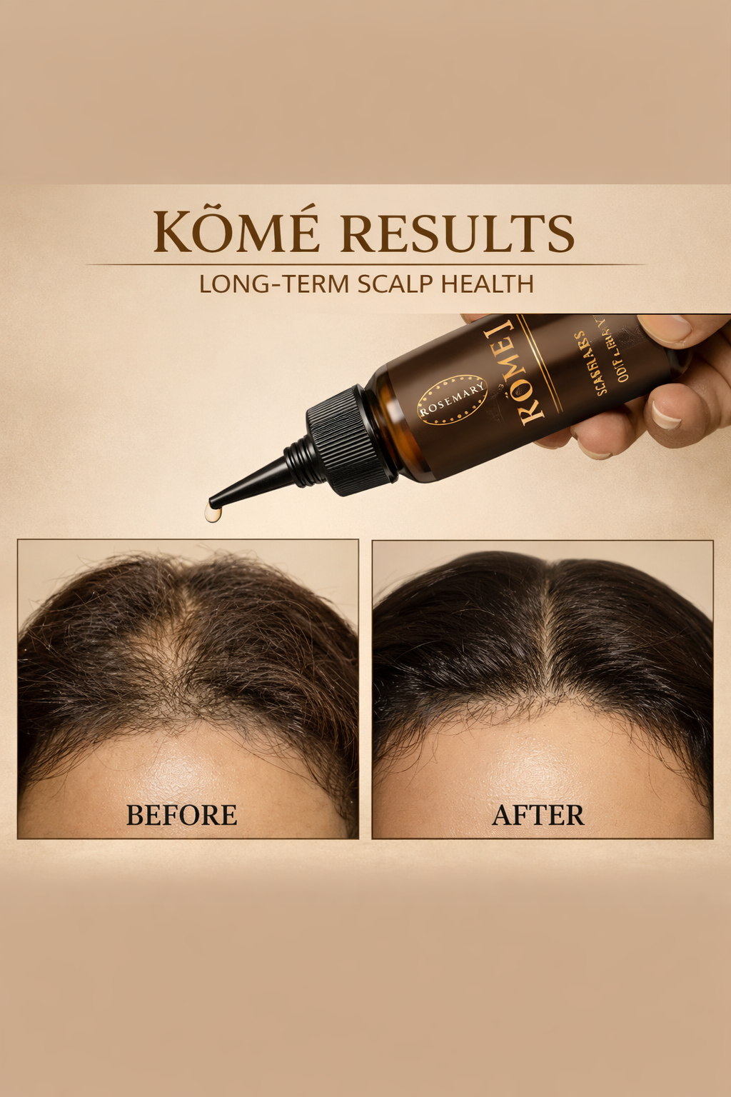 Rosemary Growth Scalp Oil